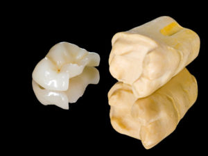 Cabinet dentaire de Coron - Prothèses